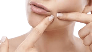 food plays important role to remove acne.