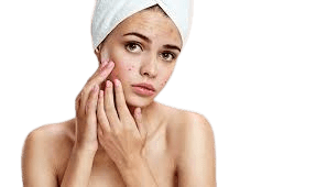 food is very important for removing acne.