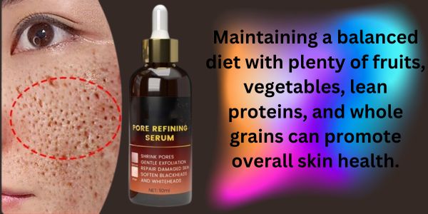 Food plays vital role to remove acne fast.