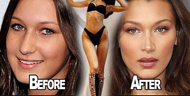 Bella Weight Loss